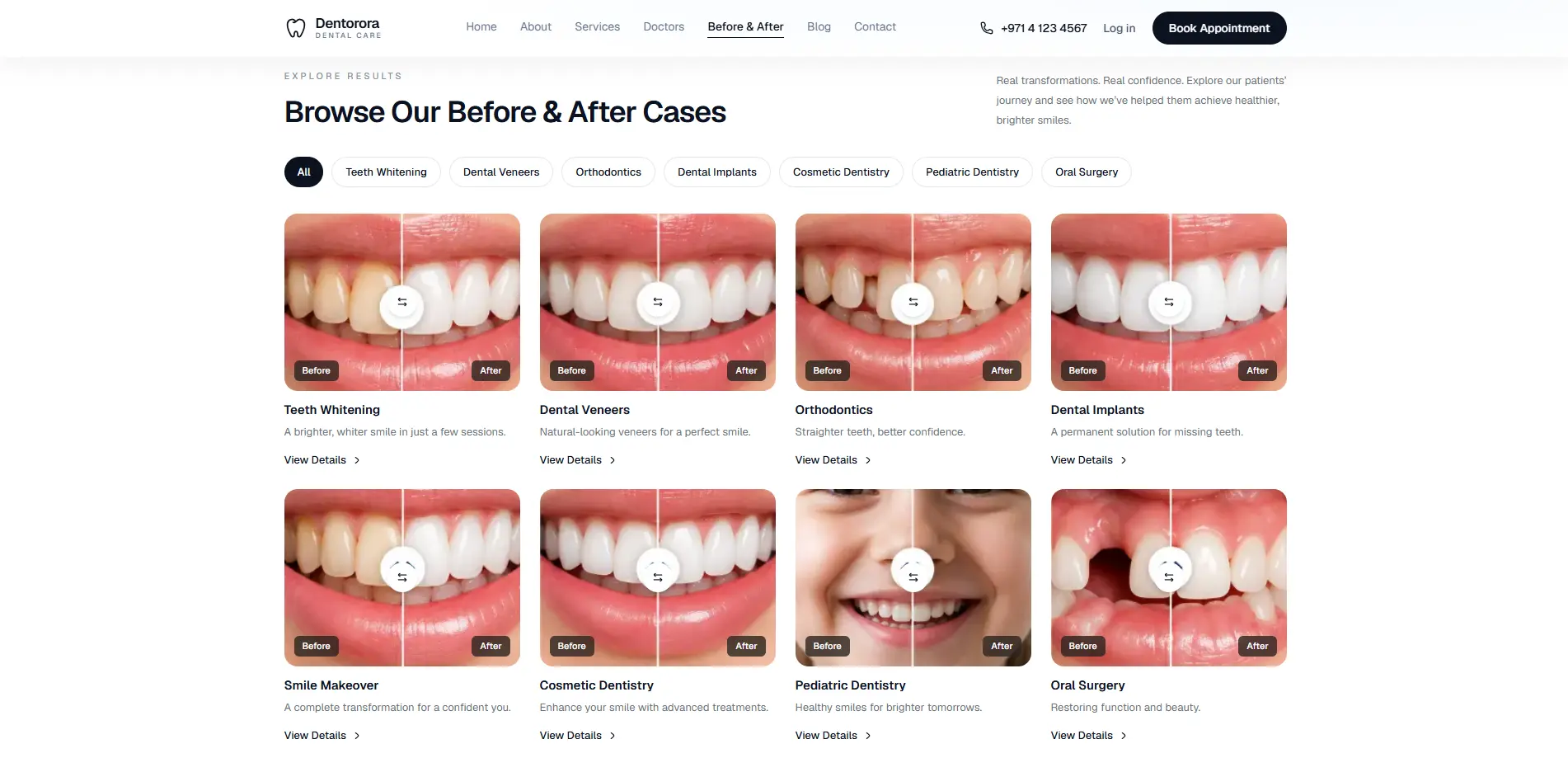 Dentora website before and after cases gallery